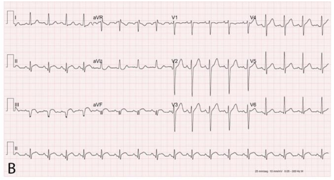 Q10_2.png (678×365)