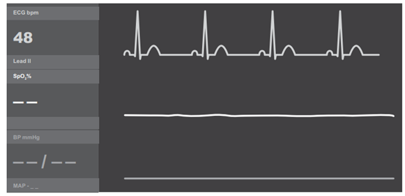 Q40.png (581×281)