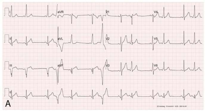 Q10_1.png (688×372)
