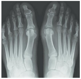 Q60D.png (273×265)