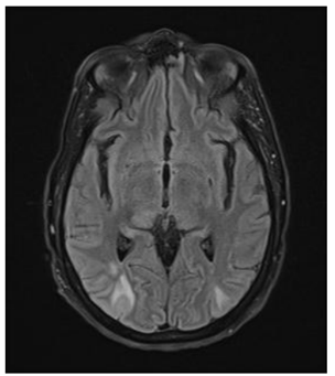 Q61.png (304×341)