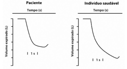 Captura_de tela 2026-09-26 063650.png (508×276)