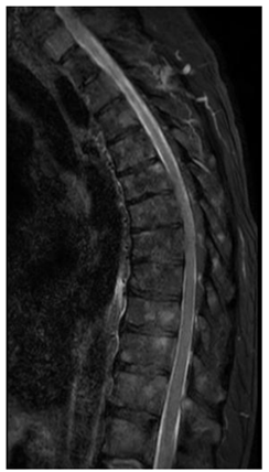Q100.png (244×428)