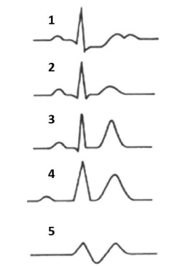Q5.png (265×381)