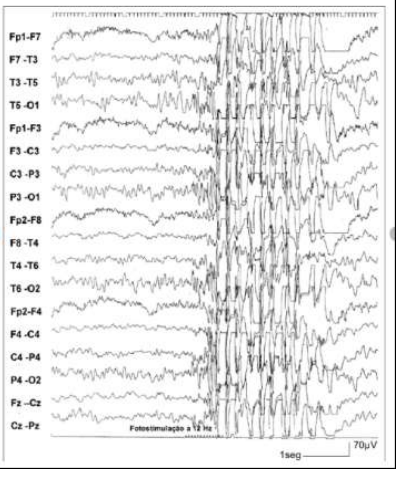 Imagem associada para resolu&ccedil;&atilde;o da quest&atilde;o