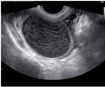 Q32.png (349&times;289)