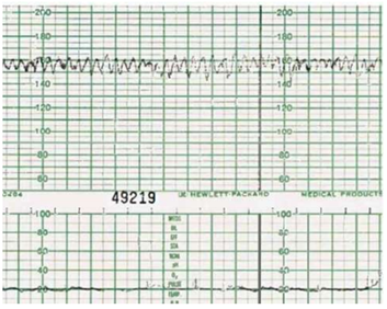 Q34.png (353&times;282)