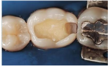 Imagem associada para resolu&ccedil;&atilde;o da quest&atilde;o