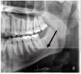 Imagem associada para resolu&ccedil;&atilde;o da quest&atilde;o