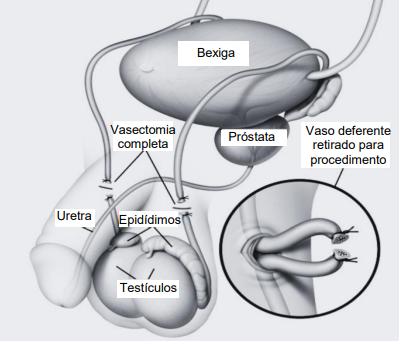 Imagem associada para resolu&ccedil;&atilde;o da quest&atilde;o