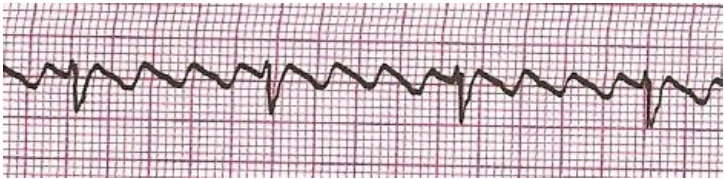 Imagem associada para resolu&ccedil;&atilde;o da quest&atilde;o