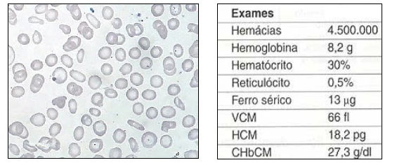 Imagem associada para resolu&ccedil;&atilde;o da quest&atilde;o