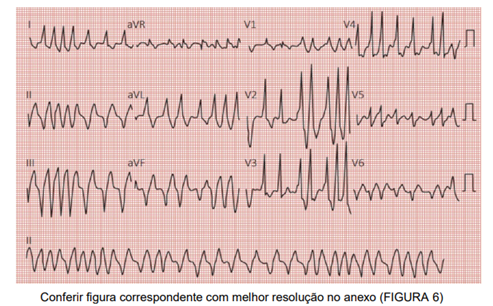 Q44.png (493&times;306)