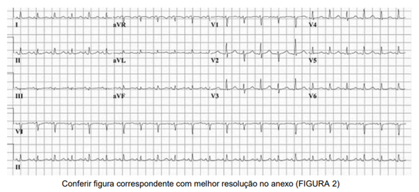 Q30.png (608&times;278)