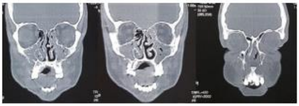 Imagem associada para resolu&ccedil;&atilde;o da quest&atilde;o