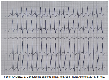 Imagem associada para resolu&ccedil;&atilde;o da quest&atilde;o