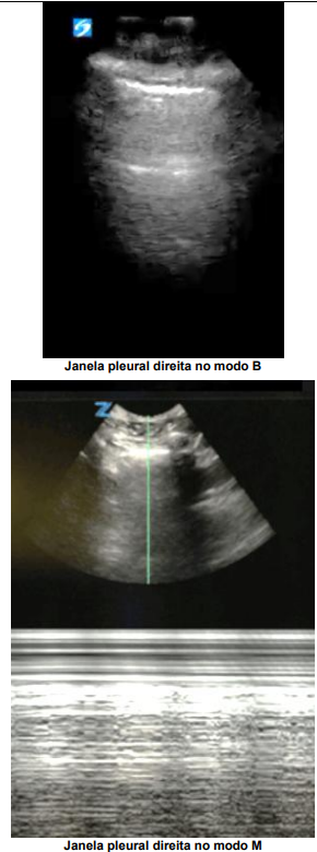 Imagem associada para resolu&ccedil;&atilde;o da quest&atilde;o