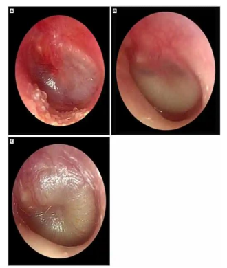 Captura_de tela 2026-04-16 095638.png (330&times;390)